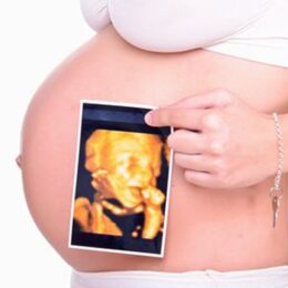 If you do not see your baby, come back another day for FREE