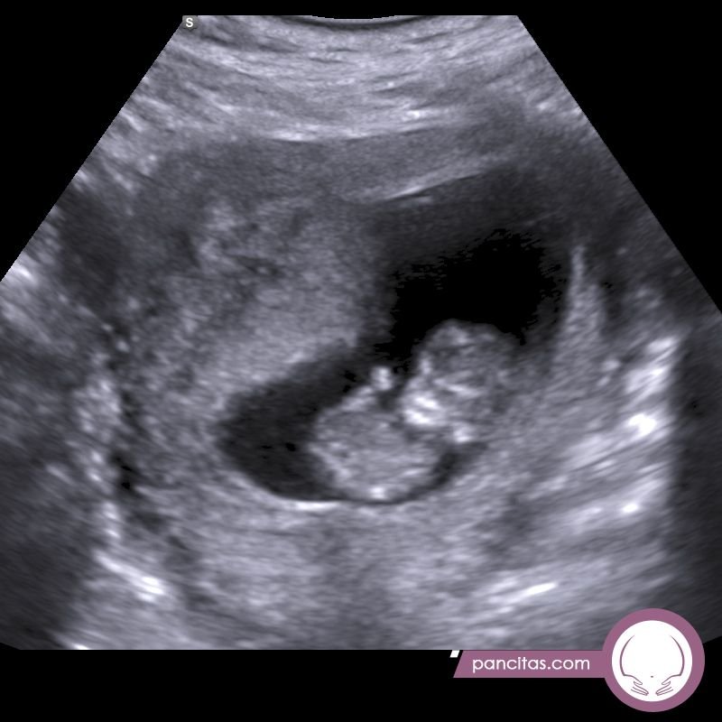 Pregnancy Ultrasounds 2D, 3D, 4D and 5D-HD